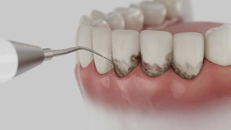 Reliable Emergency Dentist contractor in Memphis, FL by Smile Center Dentistry